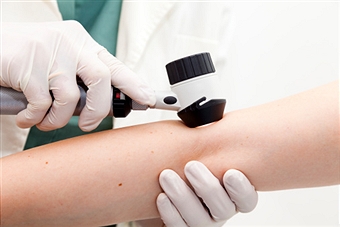 Cancer de la peau : comment le prévenir ?